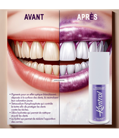 Comparaison avant et après utilisation de Kontrol, montrant l'effet blanchissant du dentifrice violet.